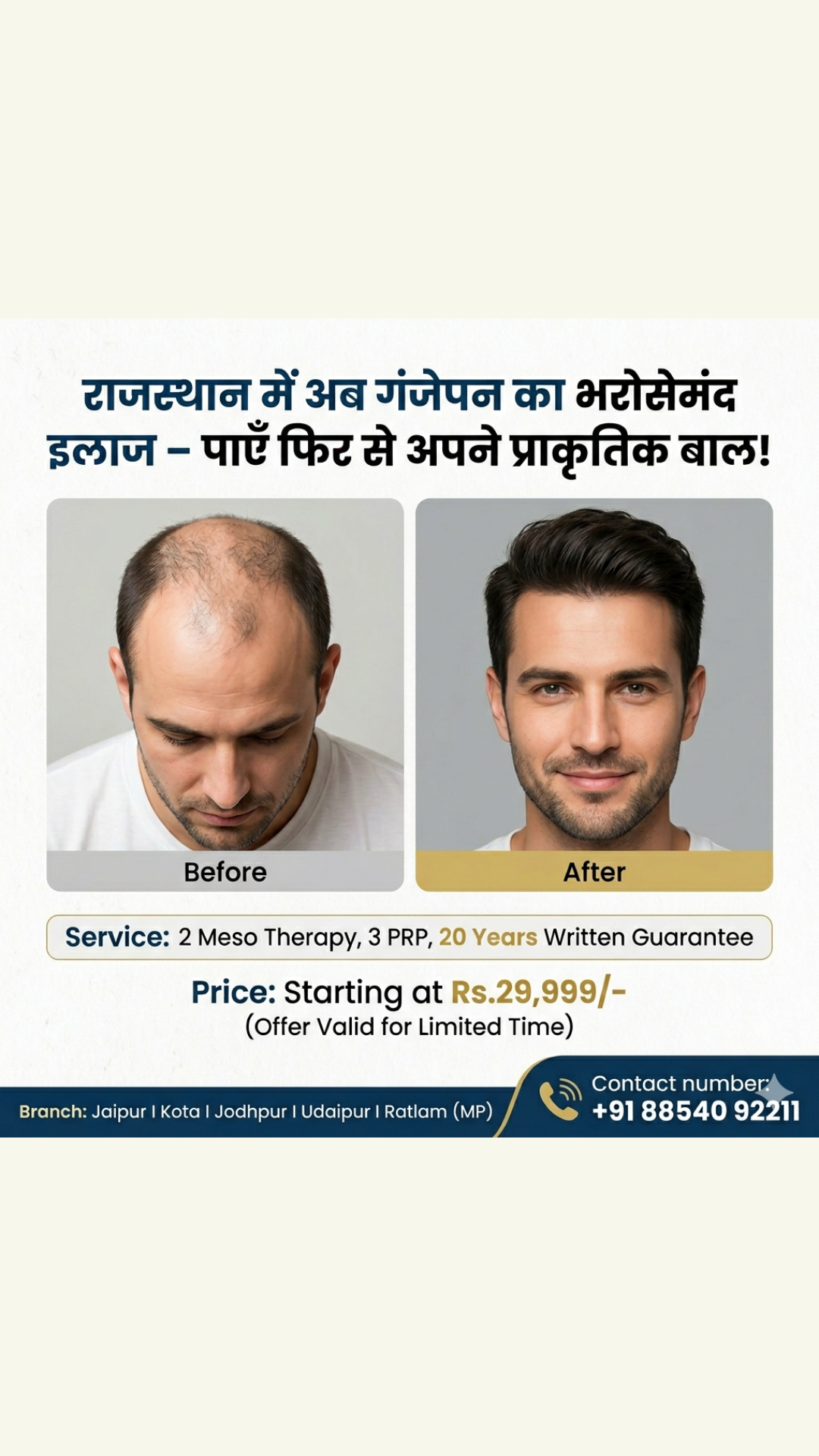 Best hair Transplant in Rajsthan-Udaypur-Kota,Jodhpur,Jaipur Facebook ad