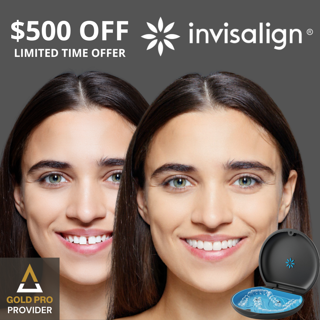 Sun Orthodontist Braces & Invisalign Facebook ad: Get $500 OFF Invisalign and FREE Teeth Whitening With…