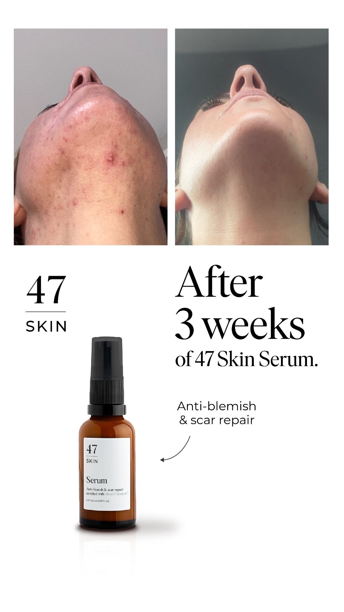 47Skin Facebook ad