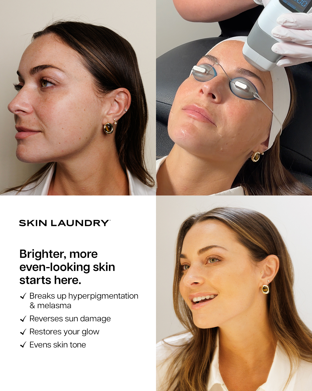 Skin Laundry Facebook ad