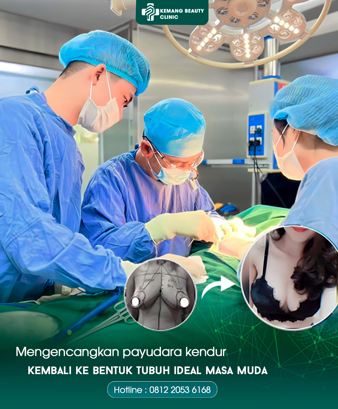 Kemang Beauty Clinic688 Facebook ad