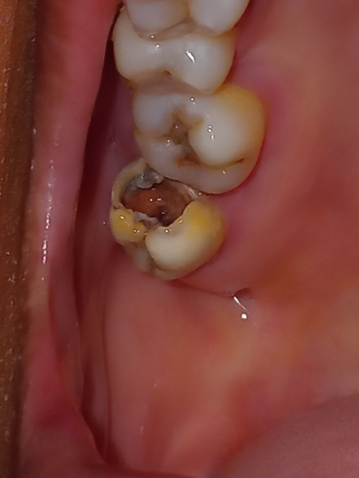 LuminoHealth Facebook ad: this took 20 years off my smile