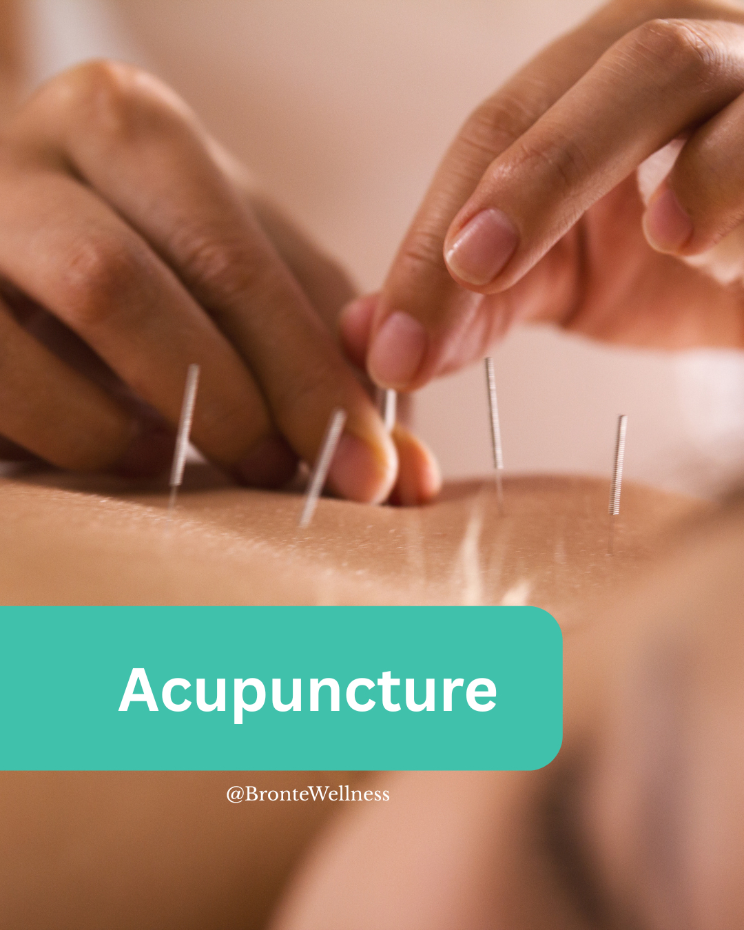 Bronte Wellness Boutique Facebook ad: Did you know our Naturopathic Doctors are trained…