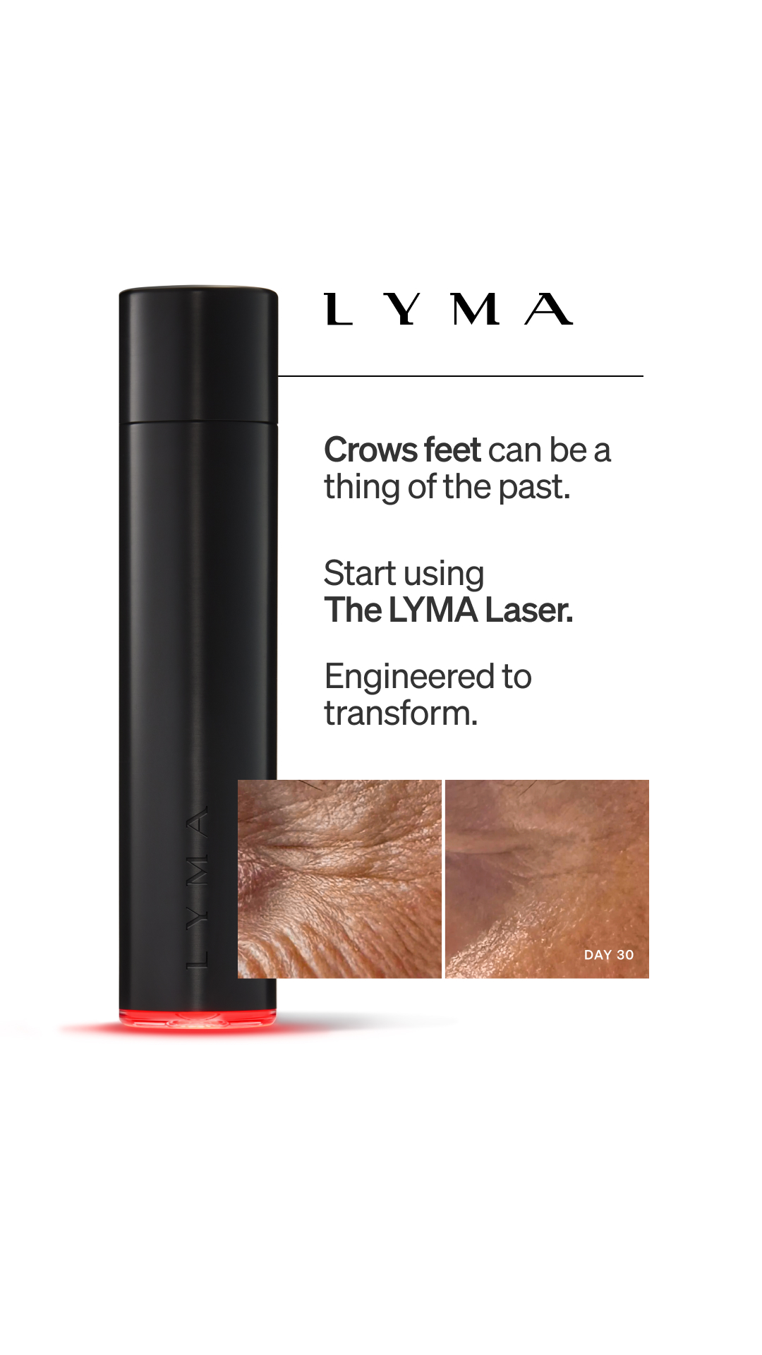 LYMA Facebook ad