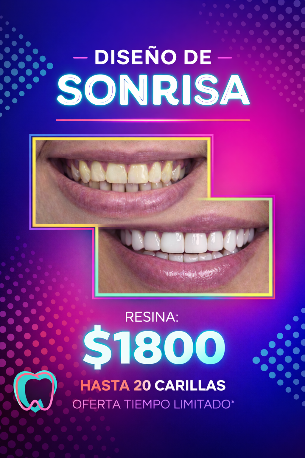 Smile Design Mia Facebook ad: Sonríe con seguridad este 2026