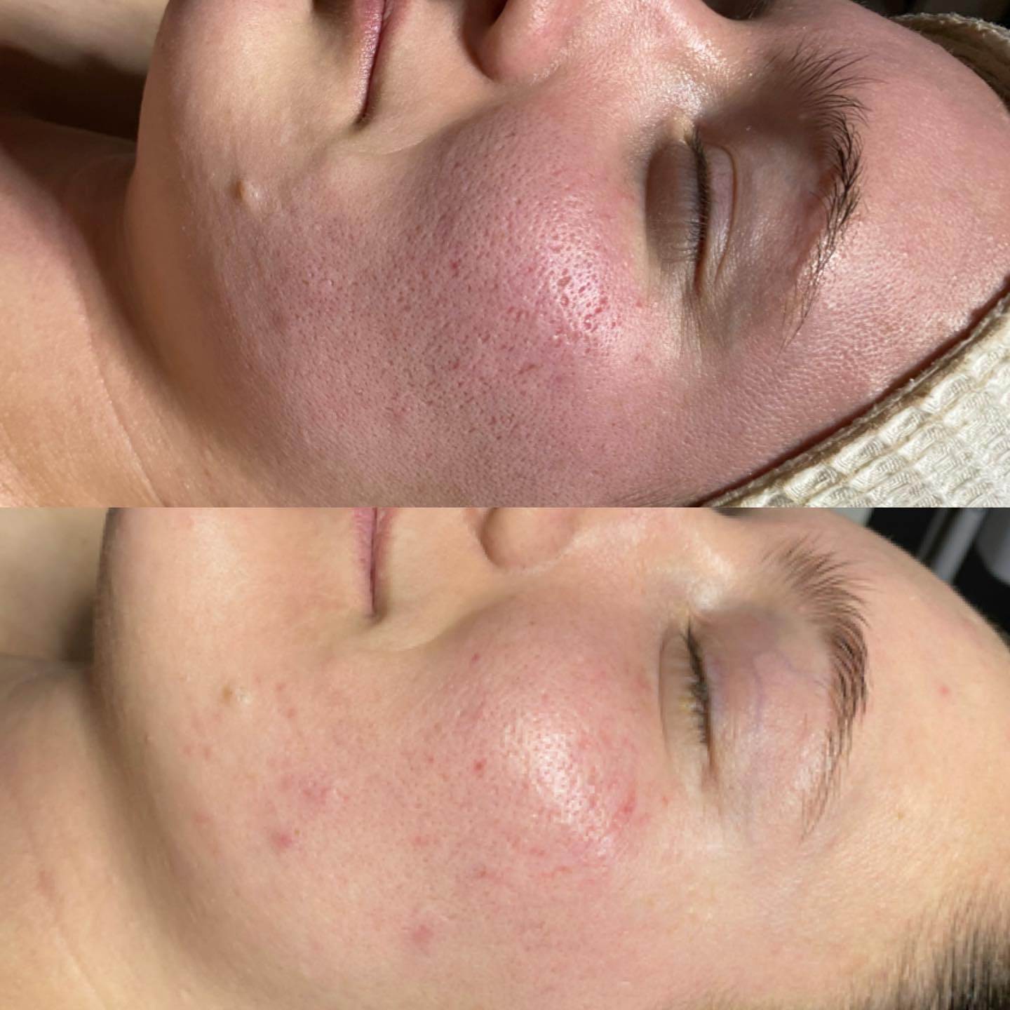 Pure Renewal Spa & Beauty Facebook ad: Skincare that works!