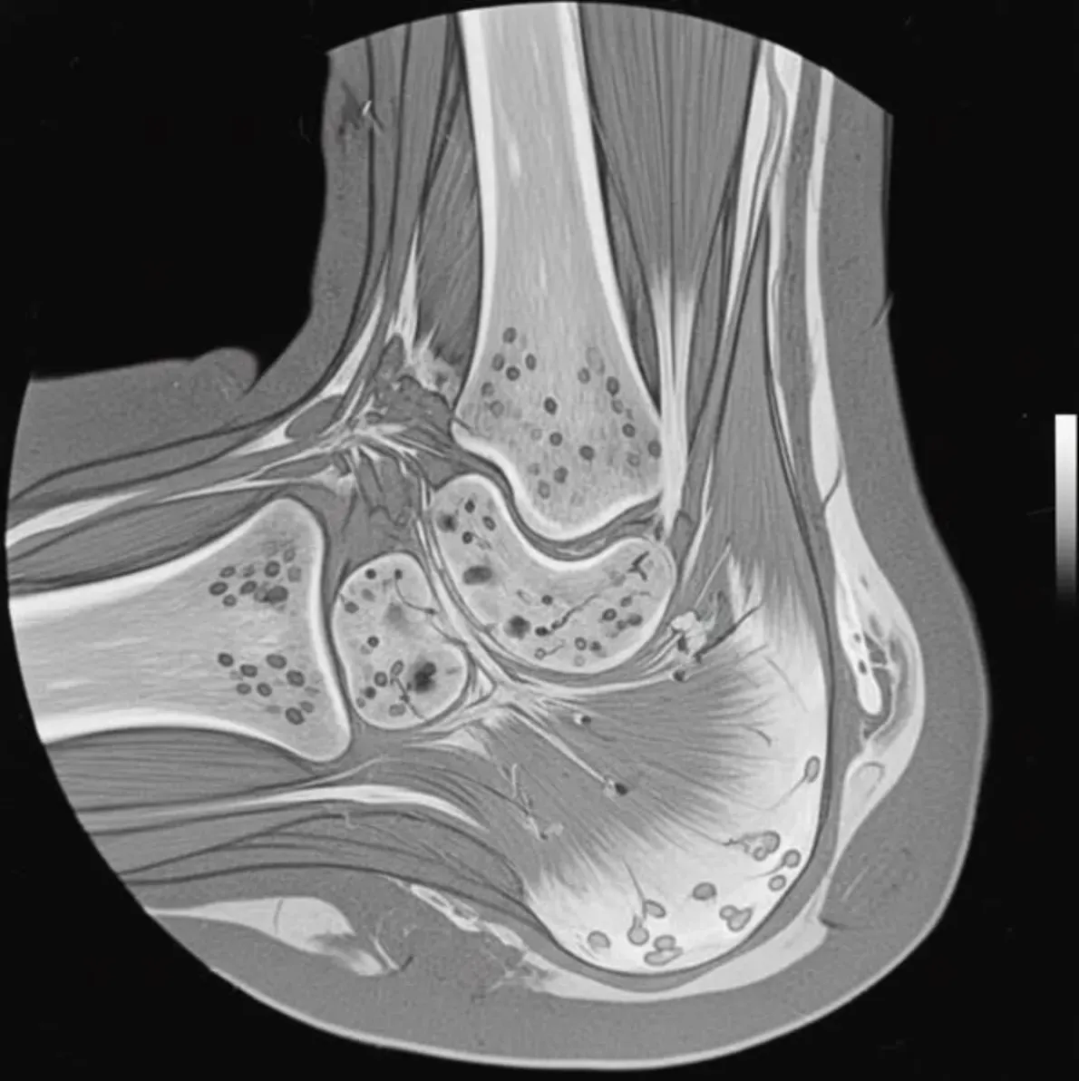 Patrick Martin Facebook ad: Top Neurophysiologist Warns: Rub This 1 Mineral Salt on…
