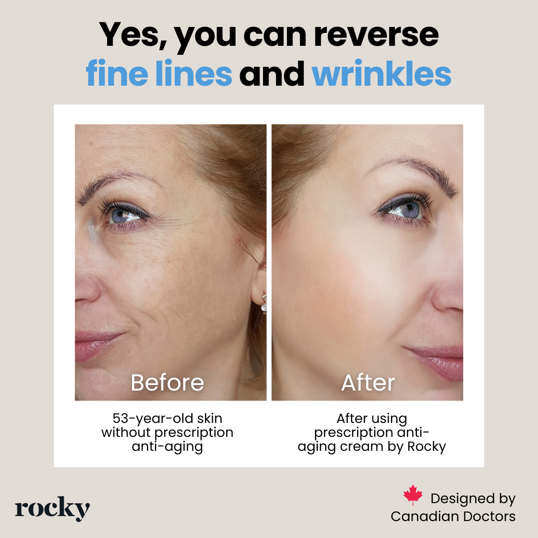 Rocky Health Inc Facebook ad