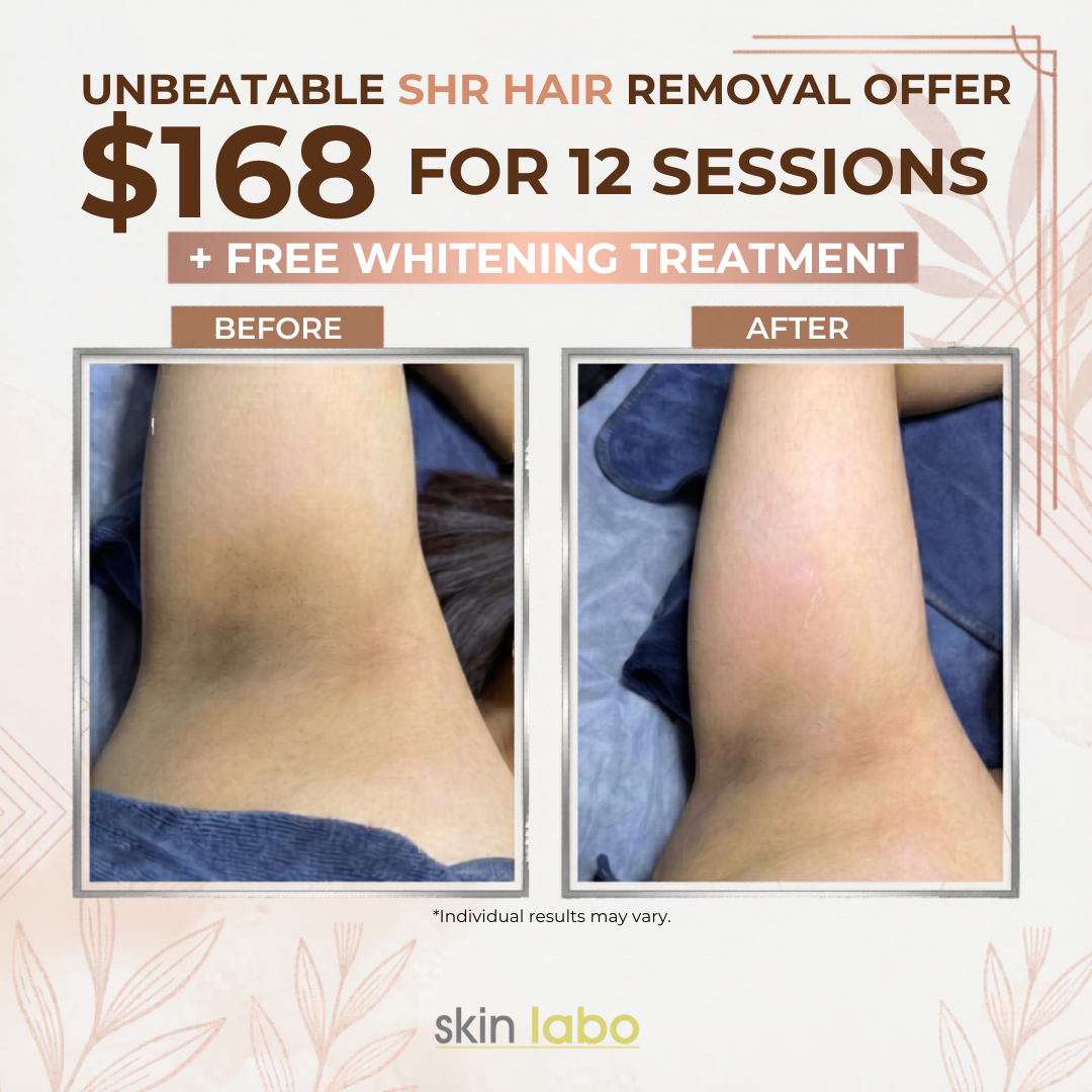 Skin Labo Facebook ad