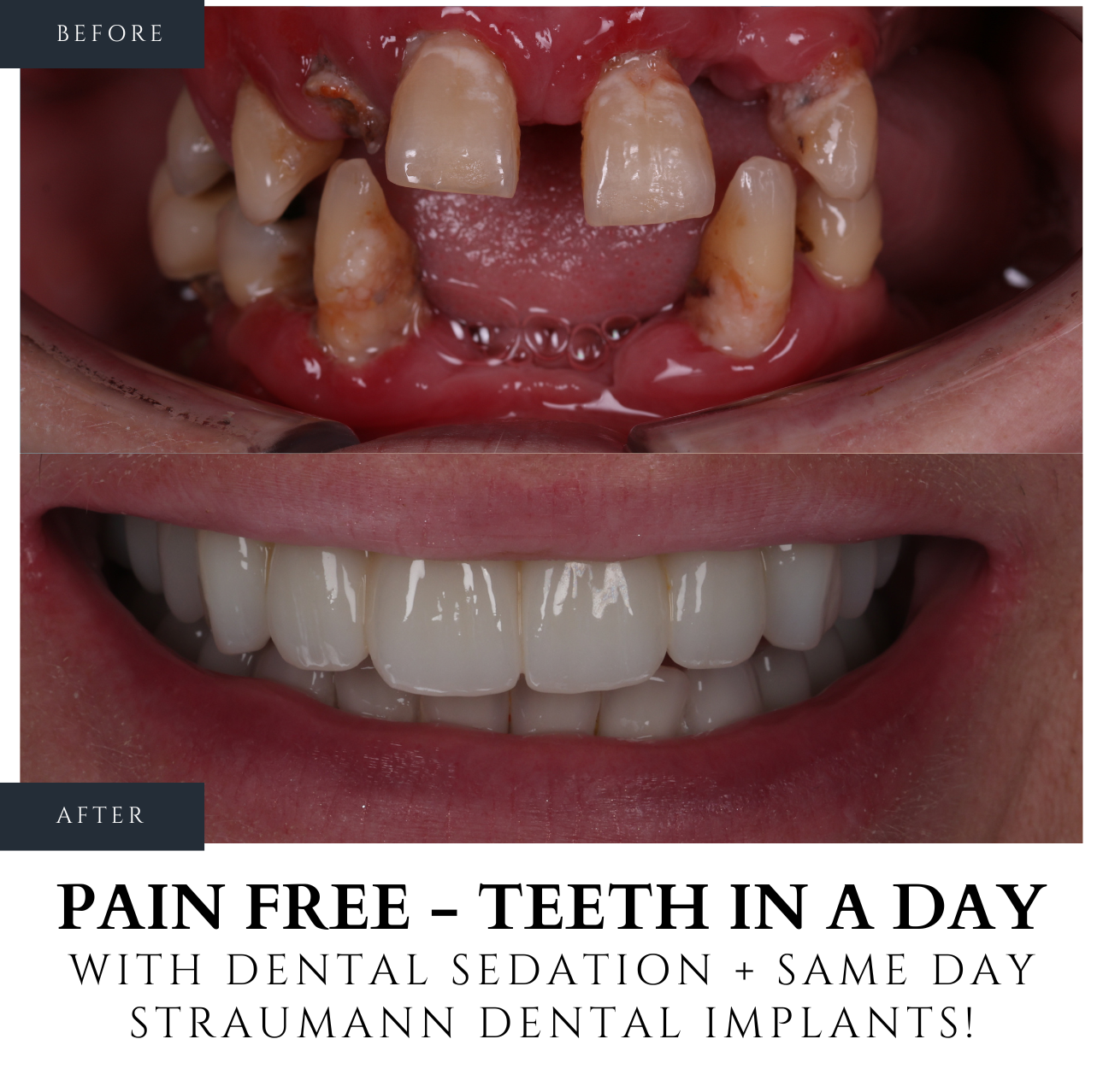 Infinity Dental Clinic Facebook ad from Jan 20, 2026