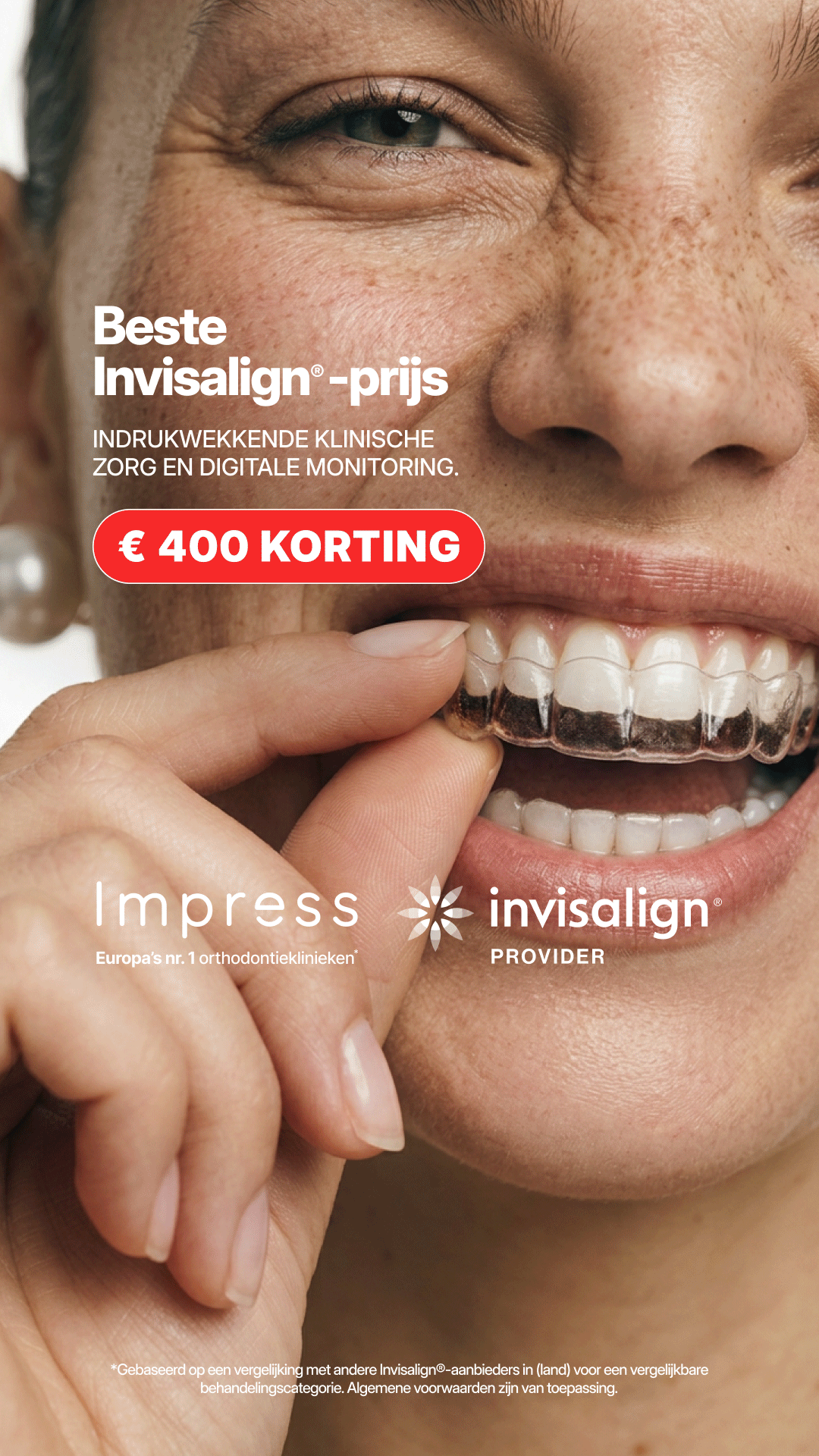 Impress Nederland Aligners Facebook ad