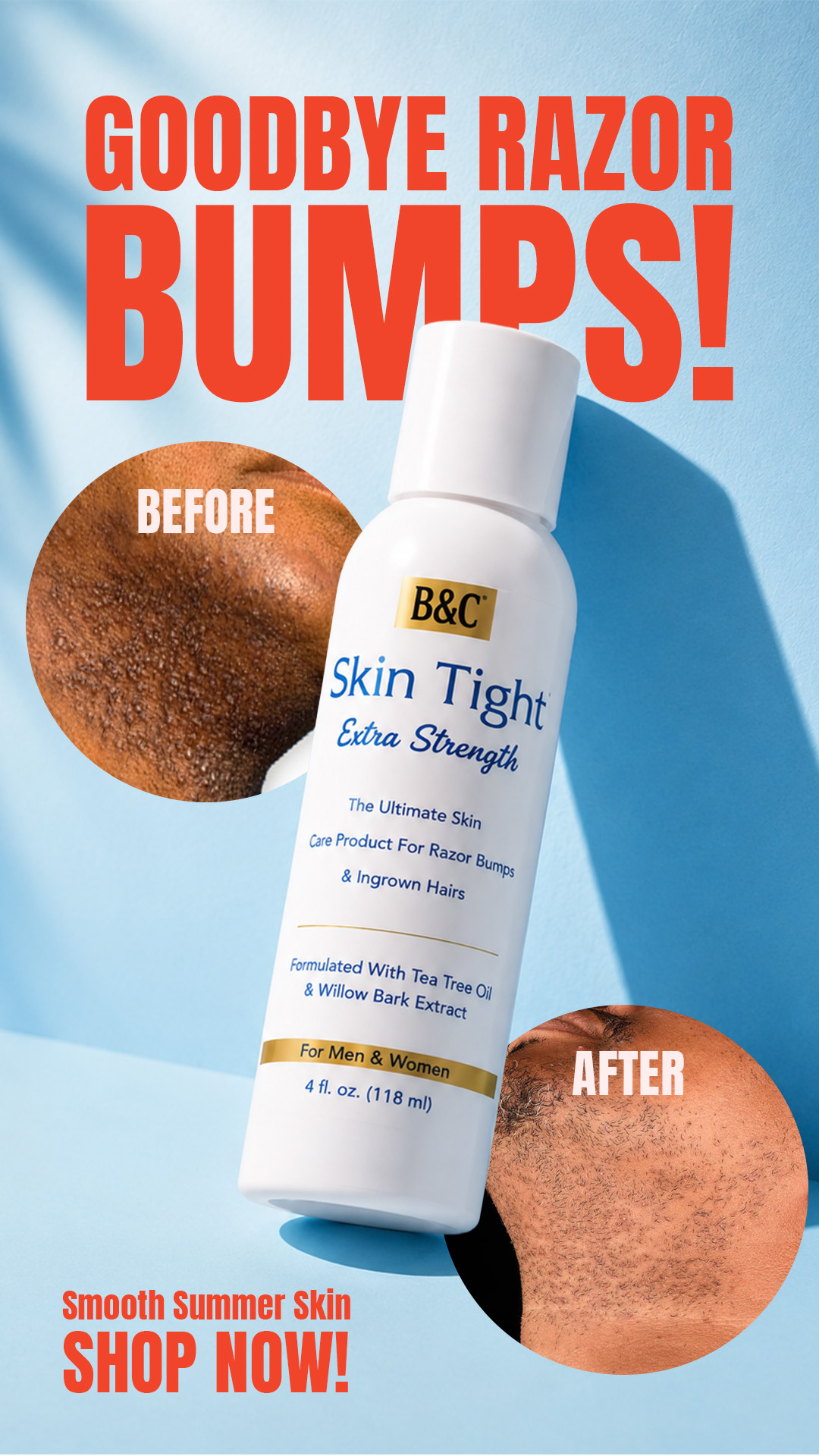 Skin Tight Facebook ad: Goodbye Razor Bumps. Hello Smooth Summer Skin.