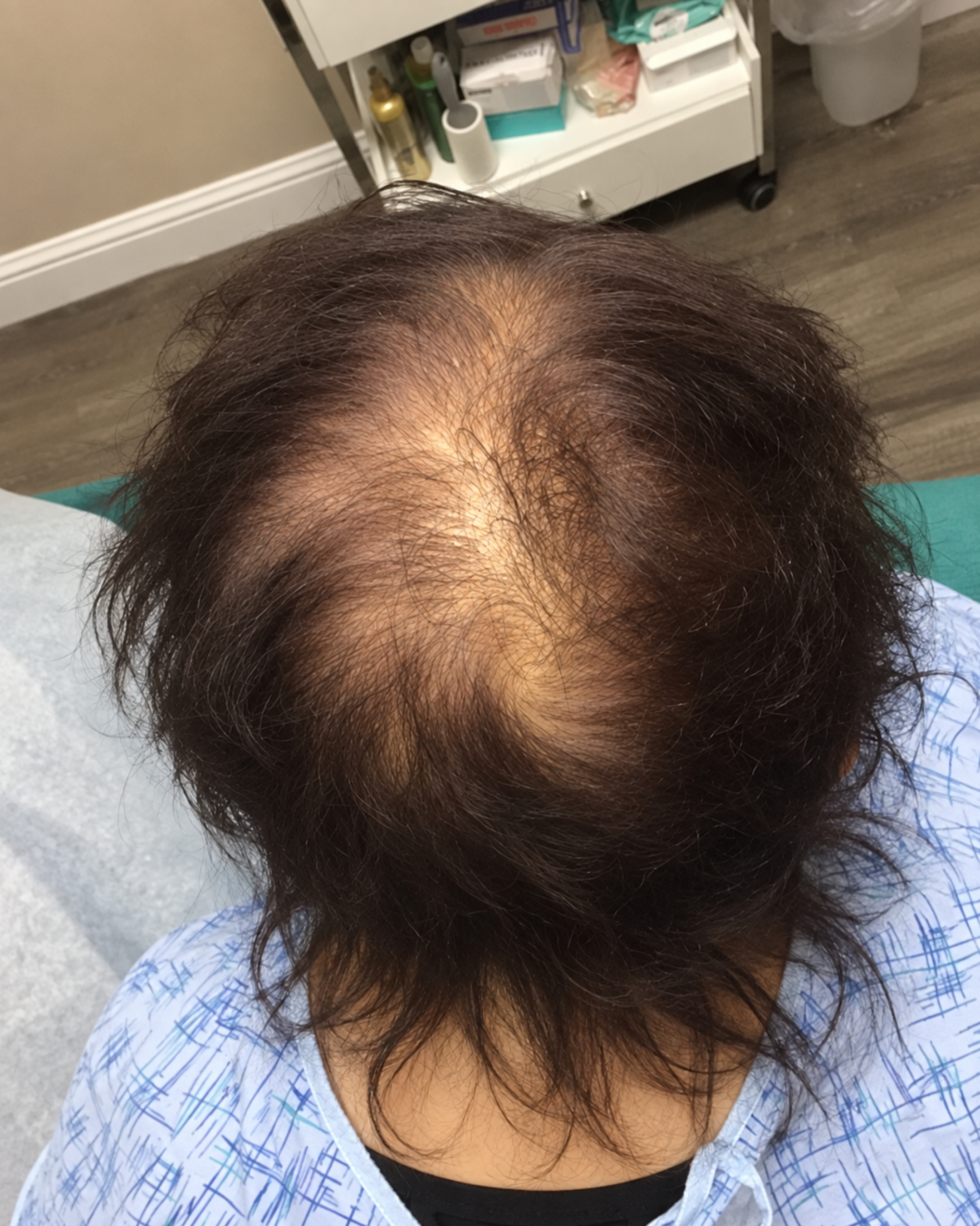 Dr. Patricia Sullivan Facebook ad: The reason why my patient was losing her hair