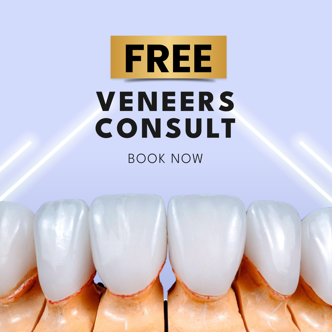 Cardiff Dental Facebook ad: FREE Dental Veneers Consult!