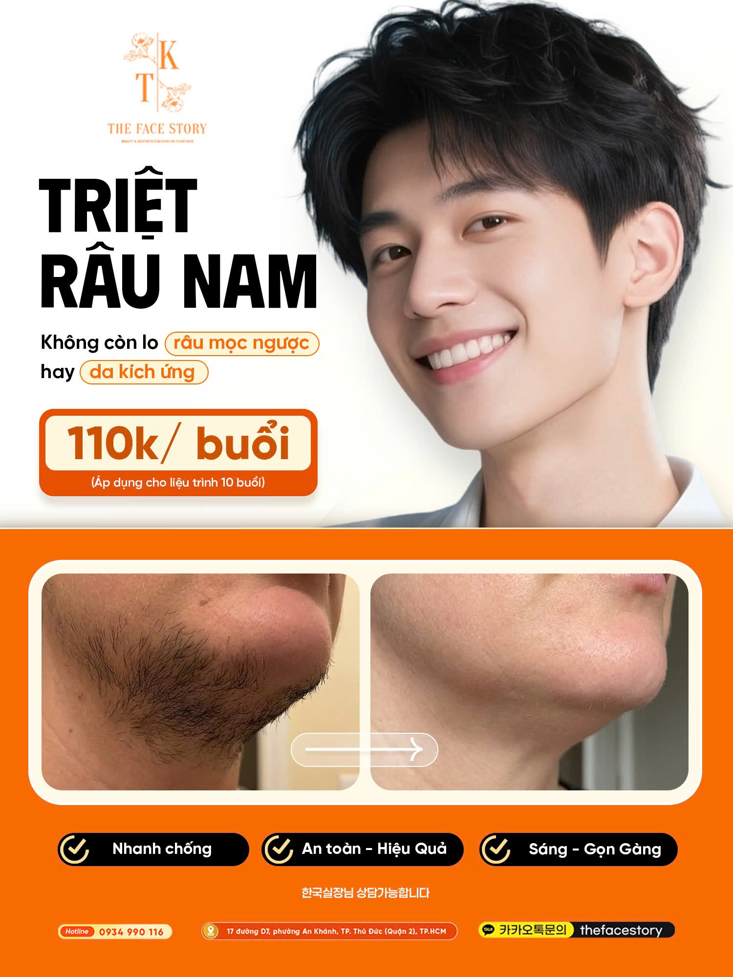 The Face Story Facebook ad: TRIỆT RÂU NAM, CHỈ 110K/BUỔI