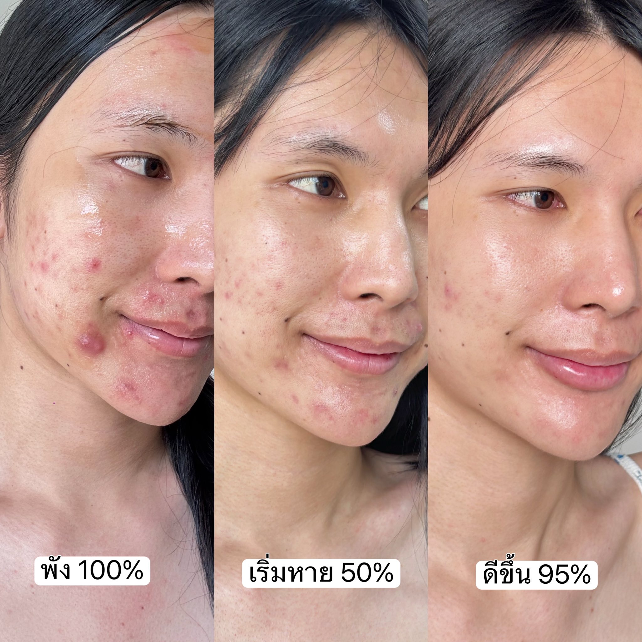 ถูกใจไอรีณ Facebook ad