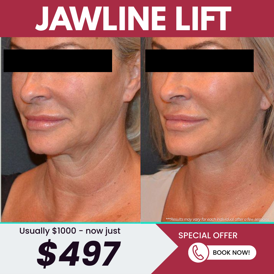 Aesthetics Health & Wellness Medspa Facebook ad: Jawline Lift for Only $497!
