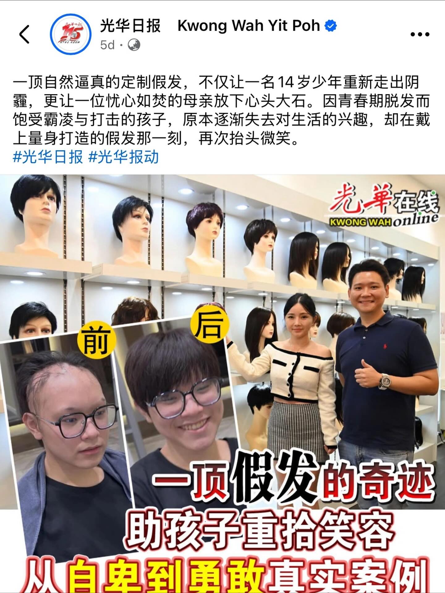 Do Wig - 专业假发定制 Facebook ad: 一顶假发的奇迹,让孩子重拾笑容