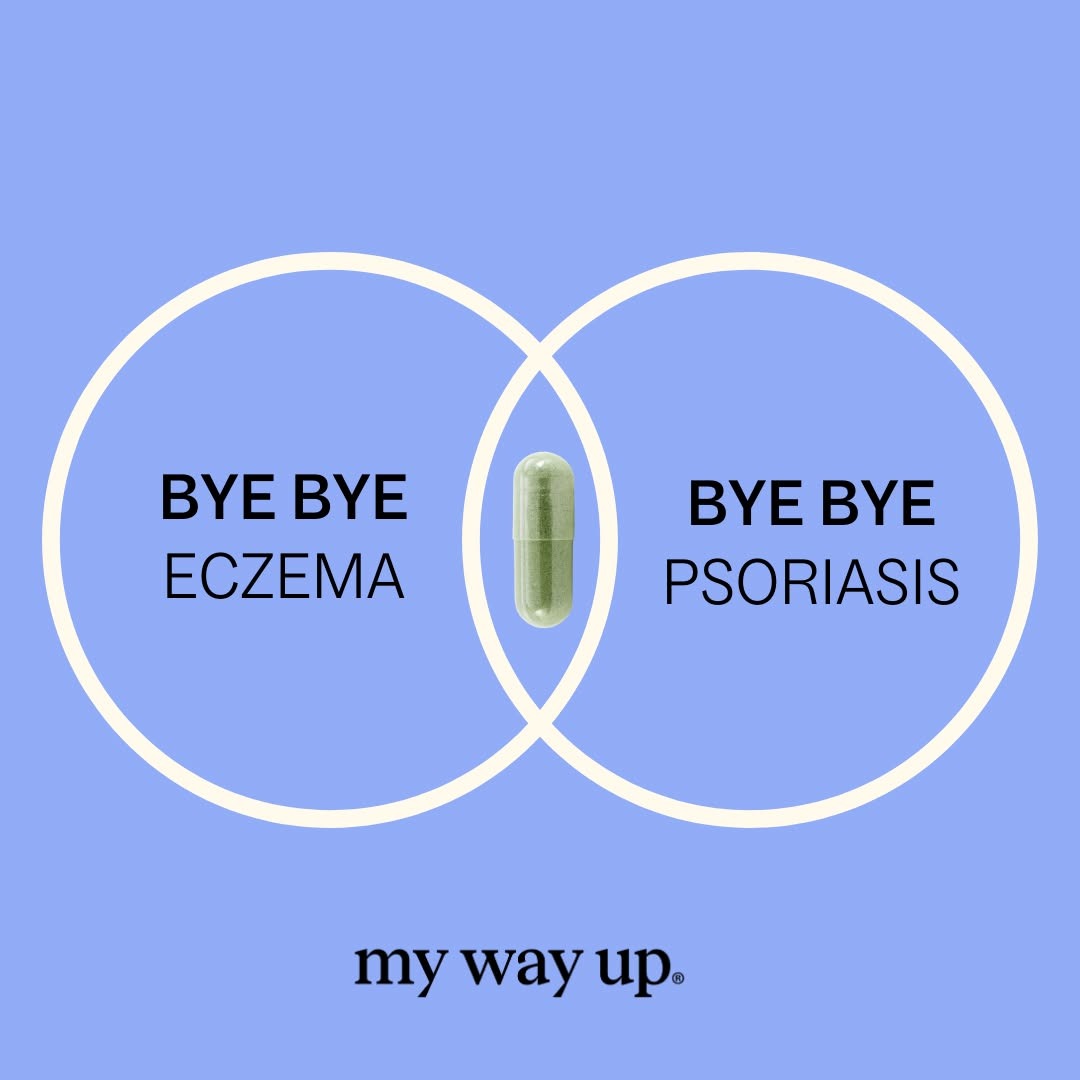 Mywayup Facebook ad