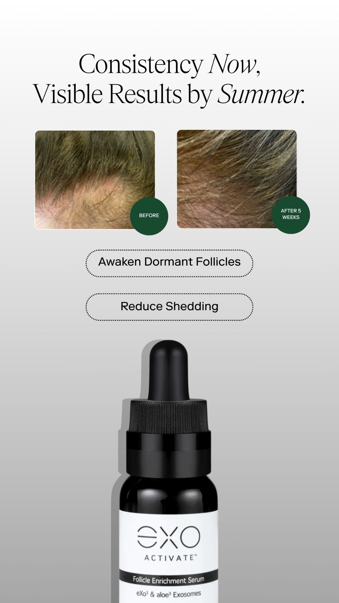 Exoceuticals Facebook ad