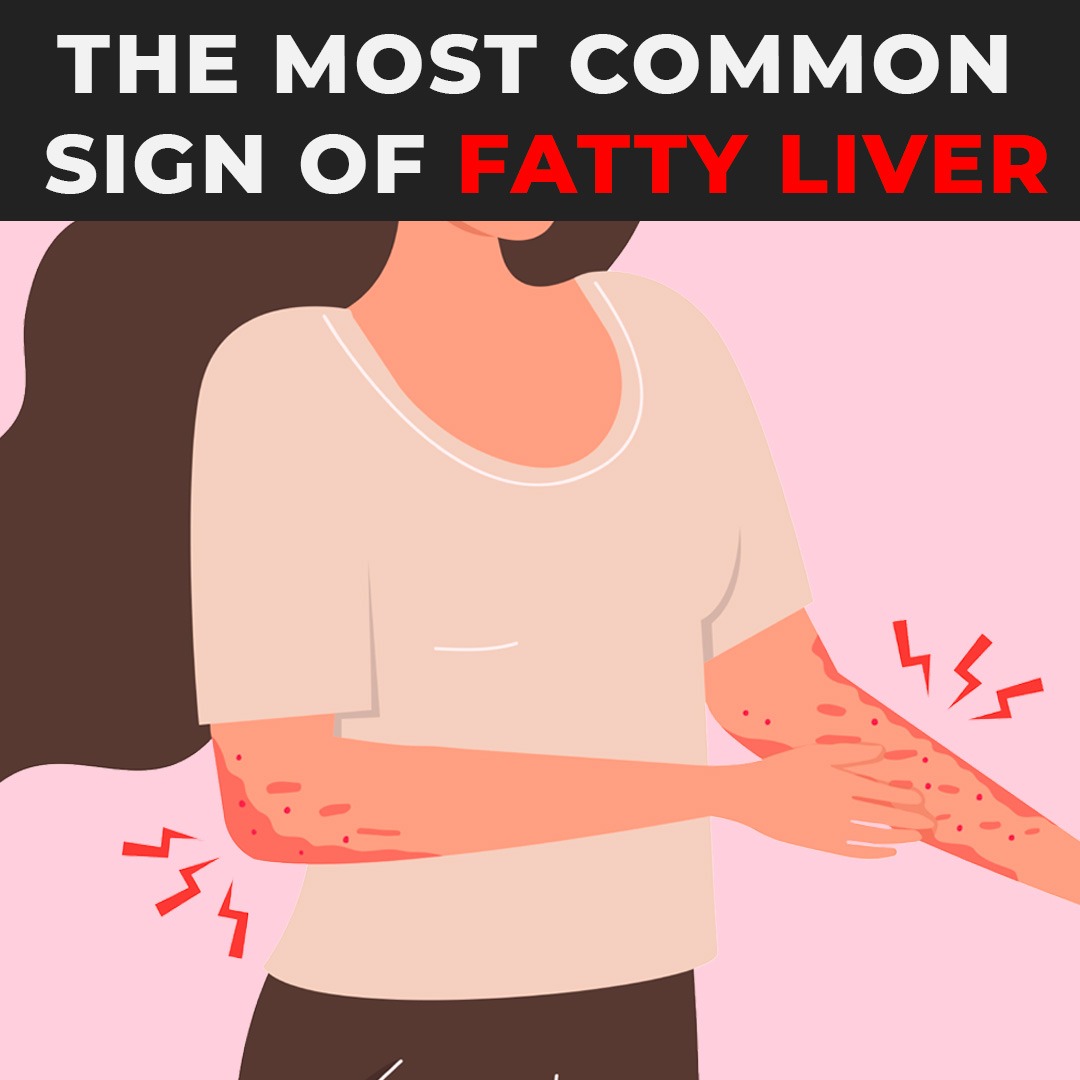 Liver Health After 40 Facebook ad: Natural Liver Supplement