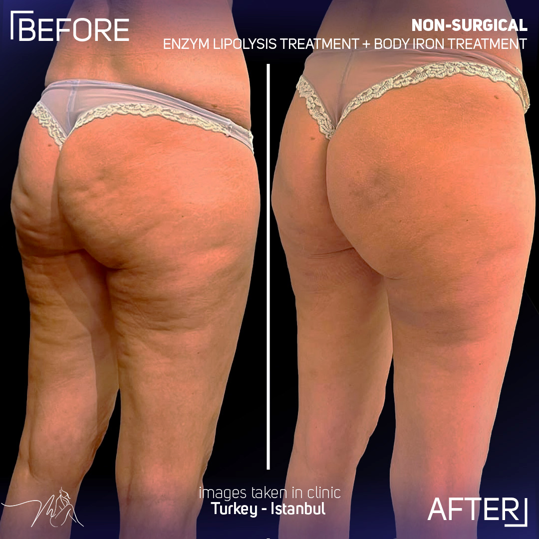 Dr. Sb. International Facebook ad: Non-surgical body contouring protocol.
