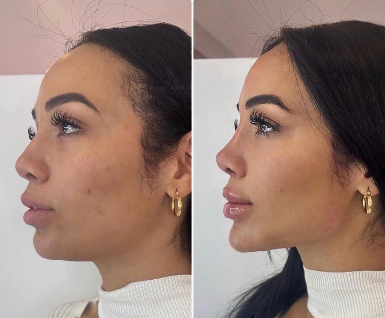 Clinica spa arte cuerpo  Facebook ad