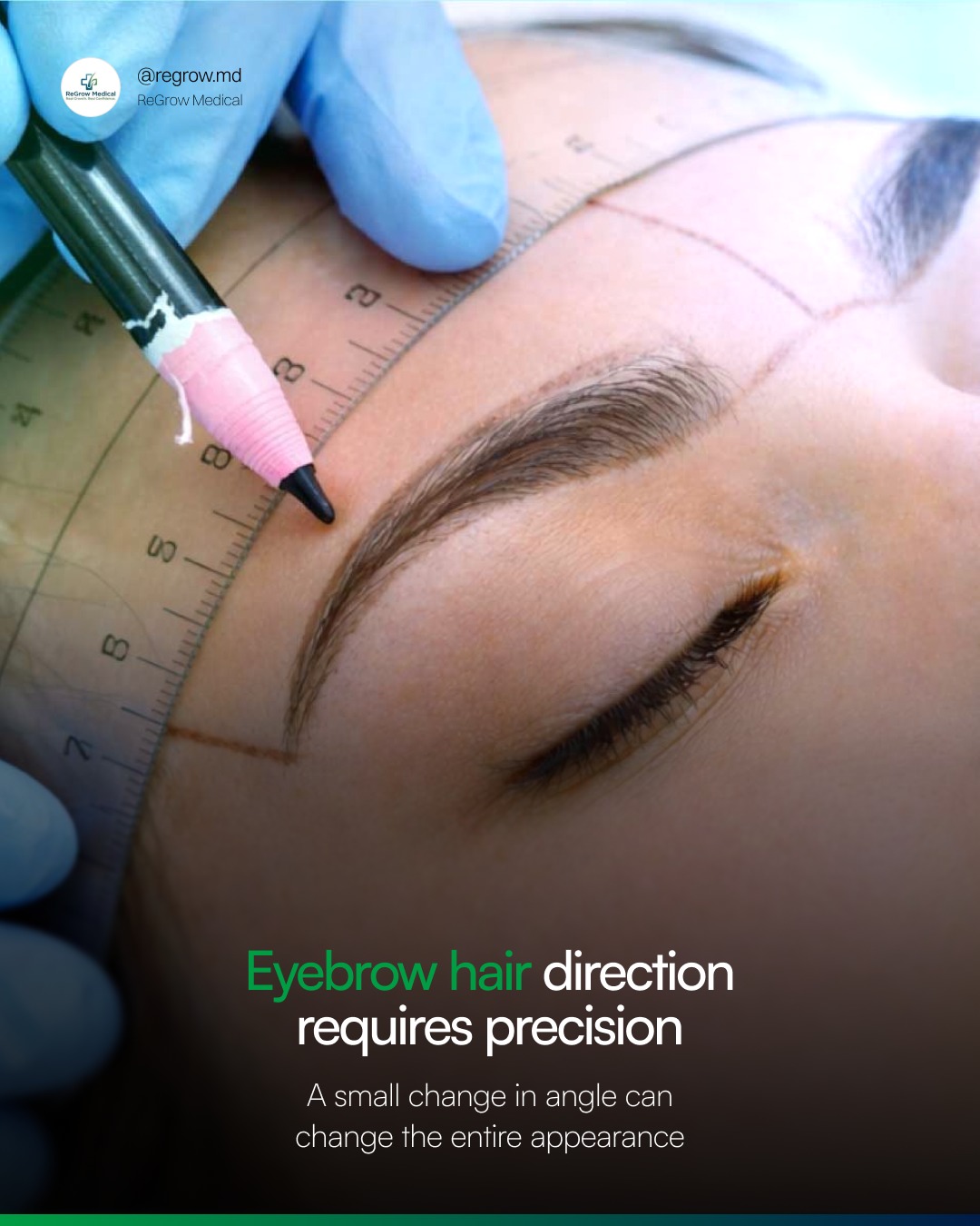 ReGrow Medical Facebook ad: Eyebrow hairs do not grow in one uniform…
