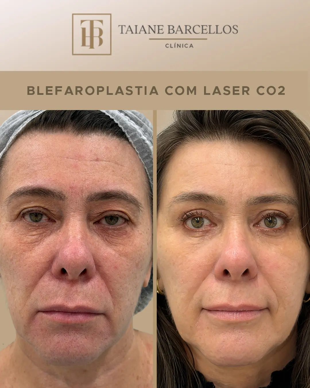 Dra. Taiane Barcellos Facebook ad