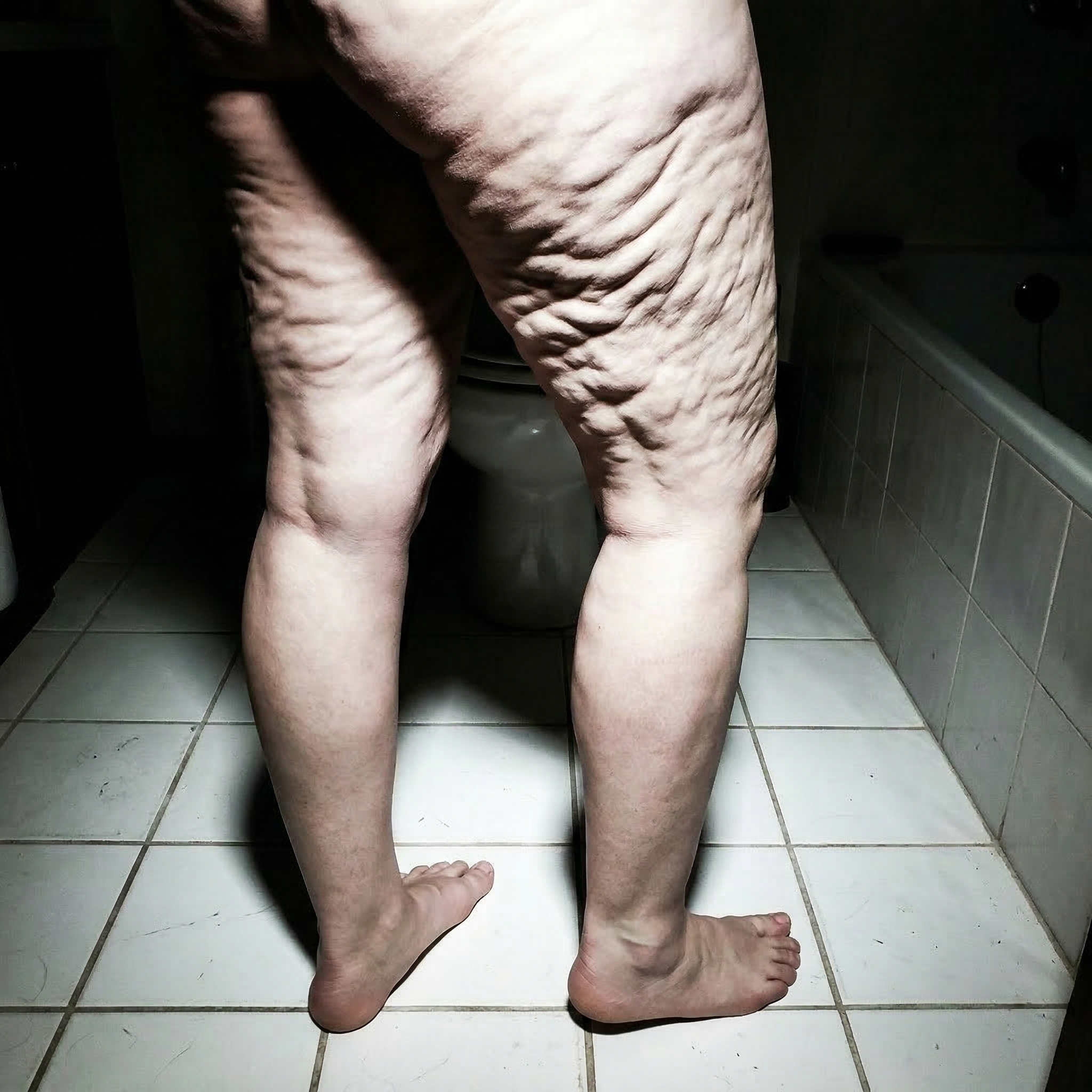 Susan Miller Facebook ad: I've Been Hiding My Legs For 3 Years.