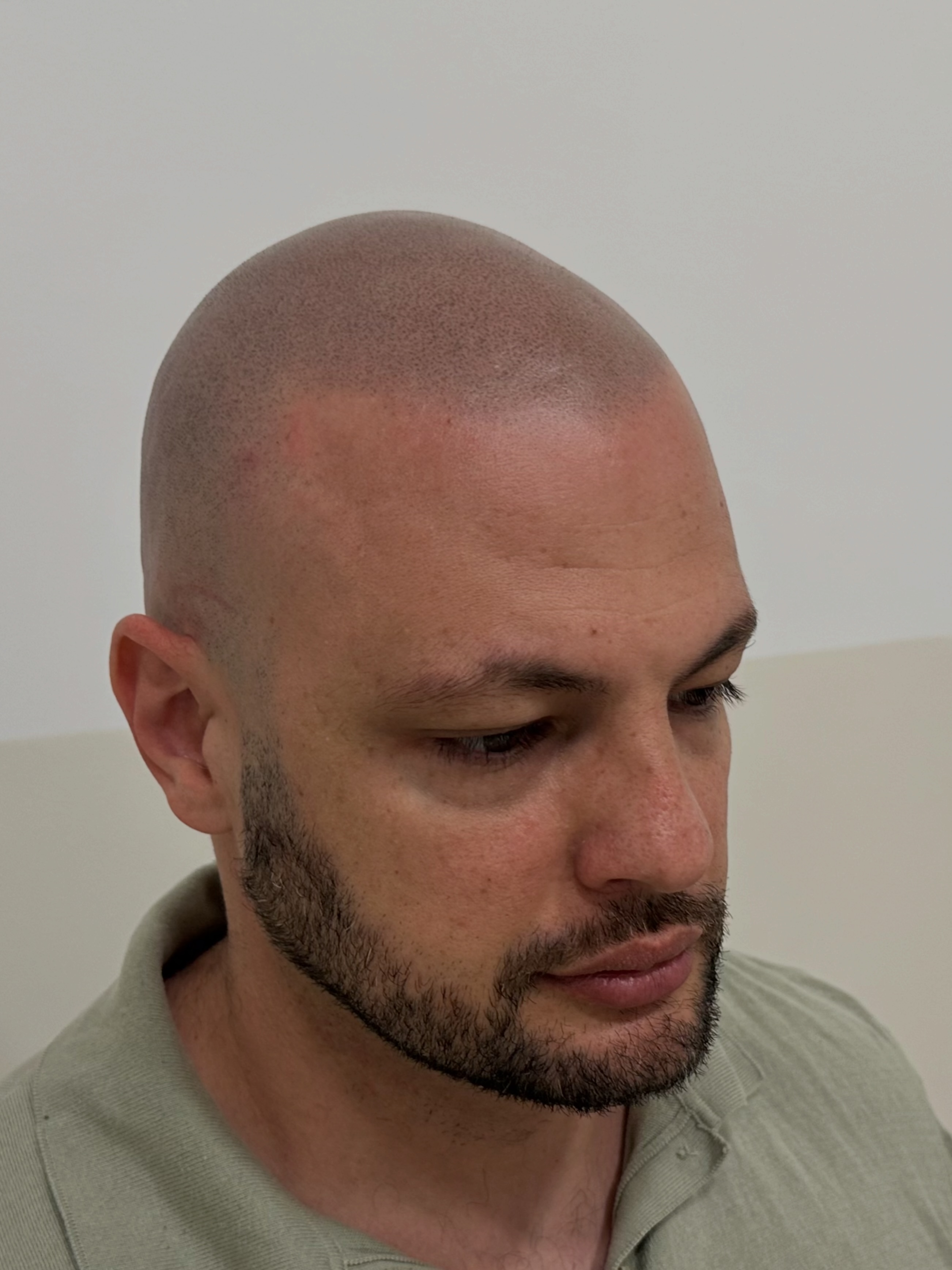 Brow Designer Angelo Tanzi Facebook ad: Trico effetto rasato, super naturale e realistico.