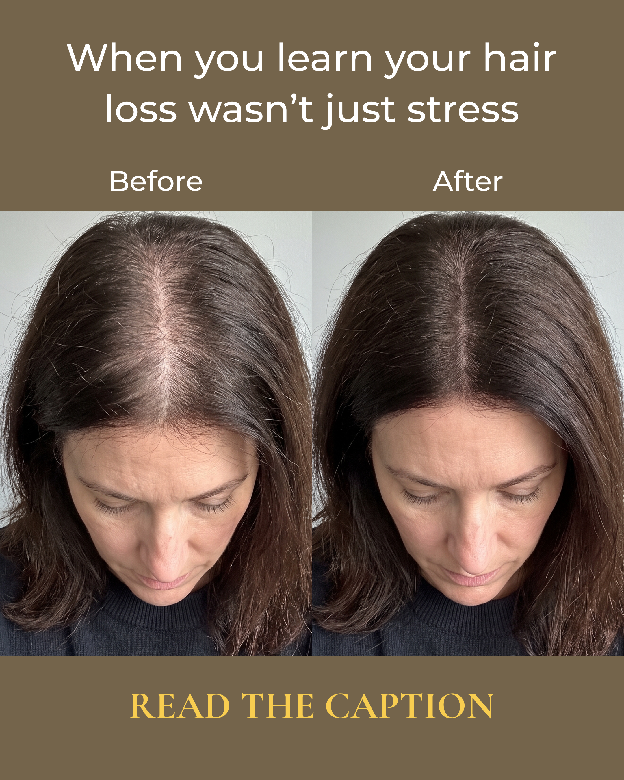Dr. Patricia Sullivan Facebook ad: The Warning Sign Behind Your Hair Loss