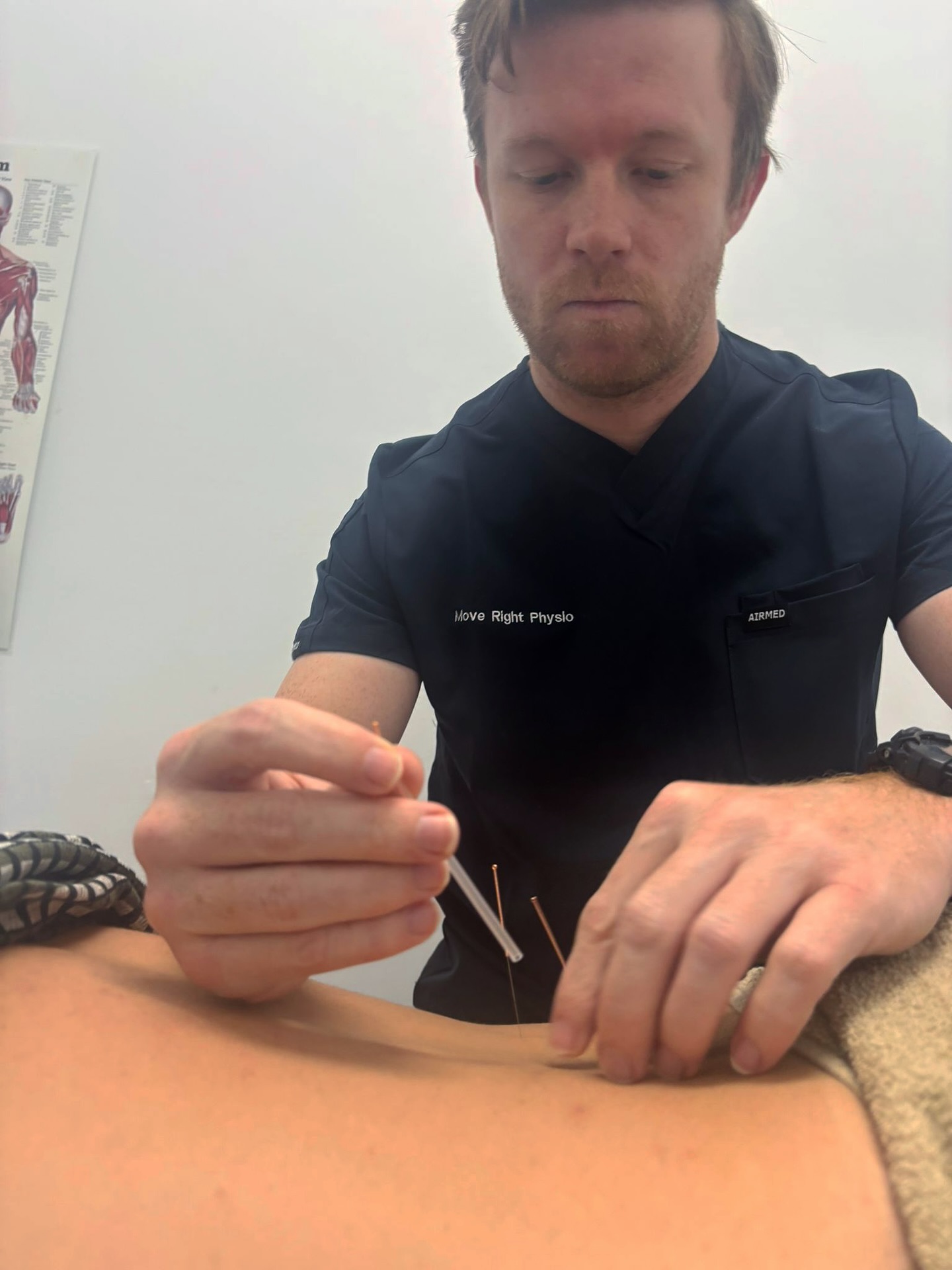 Move Right Physio Facebook ad: Dry Needling, more than just tiny needles!