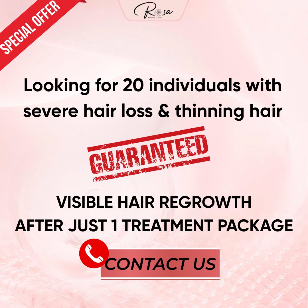 Rosa Aesthetic - Makati's No. 1 Intensive Hair Treatment Facebook ad: SPECIAL OFFER, LIMITED SLOTS