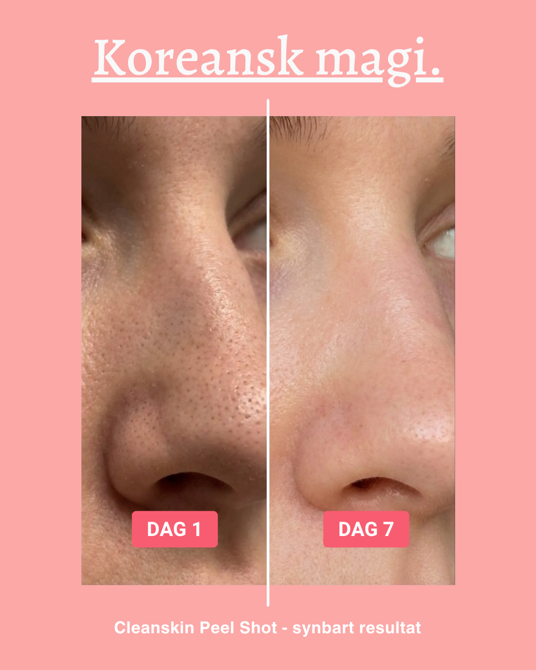 Cleanskin Store Facebook ad: Känn dig bekväm med din hud igen