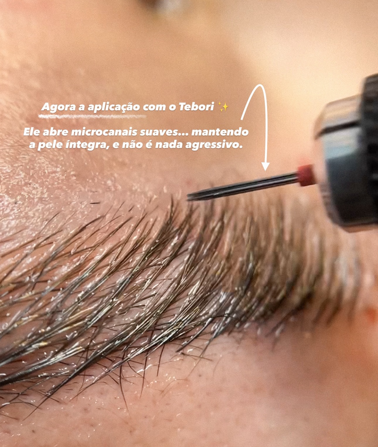 Isabela Mikhail Facebook ad: Mostrando de uma forma resumida como é as…