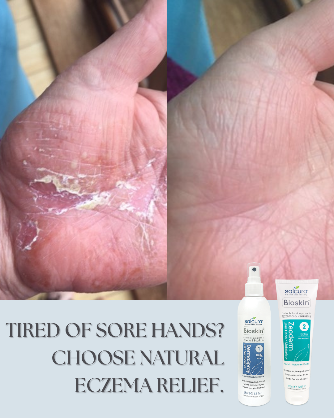 Salcura Ireland Facebook ad: Sick of red sore hands that crack at everything?