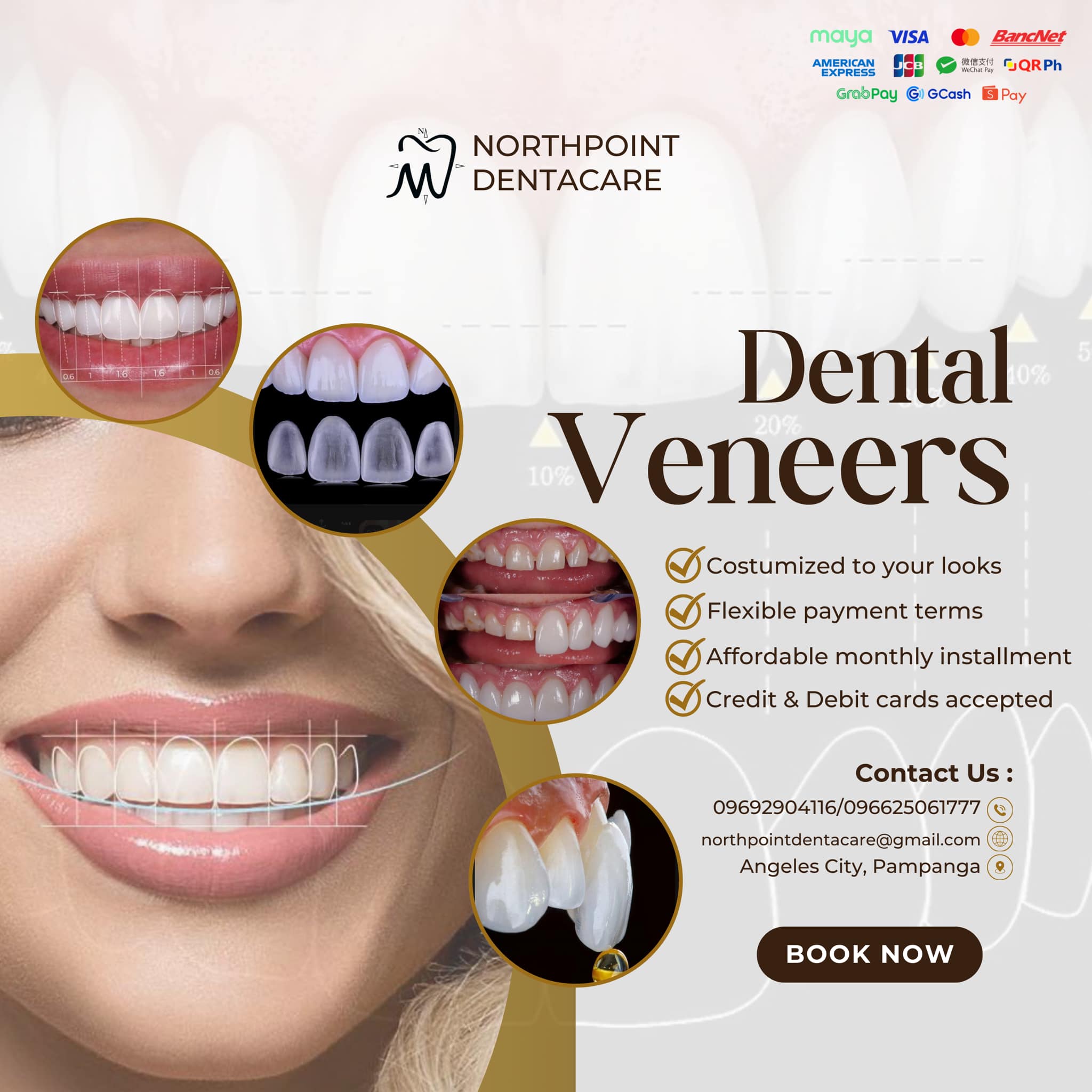 Northpoint Dentacare - Angeles City Dental Clinic Facebook ad