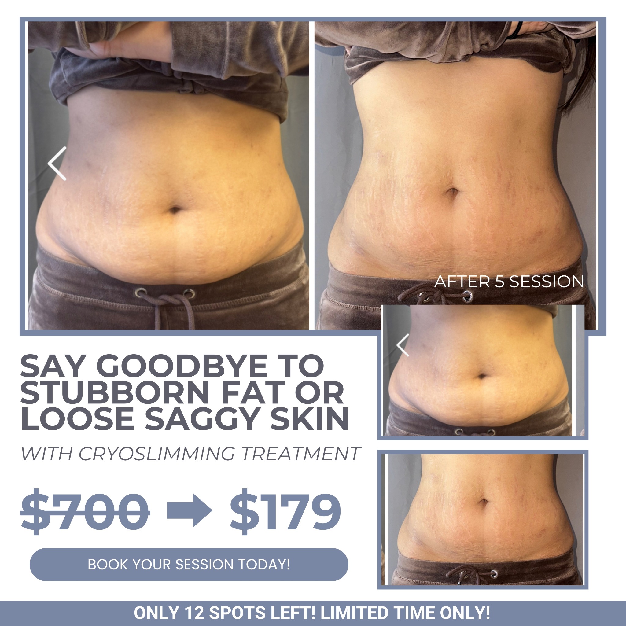 US Cryotherapy - Danville / San Ramon Facebook ad from Jun 17, 2026