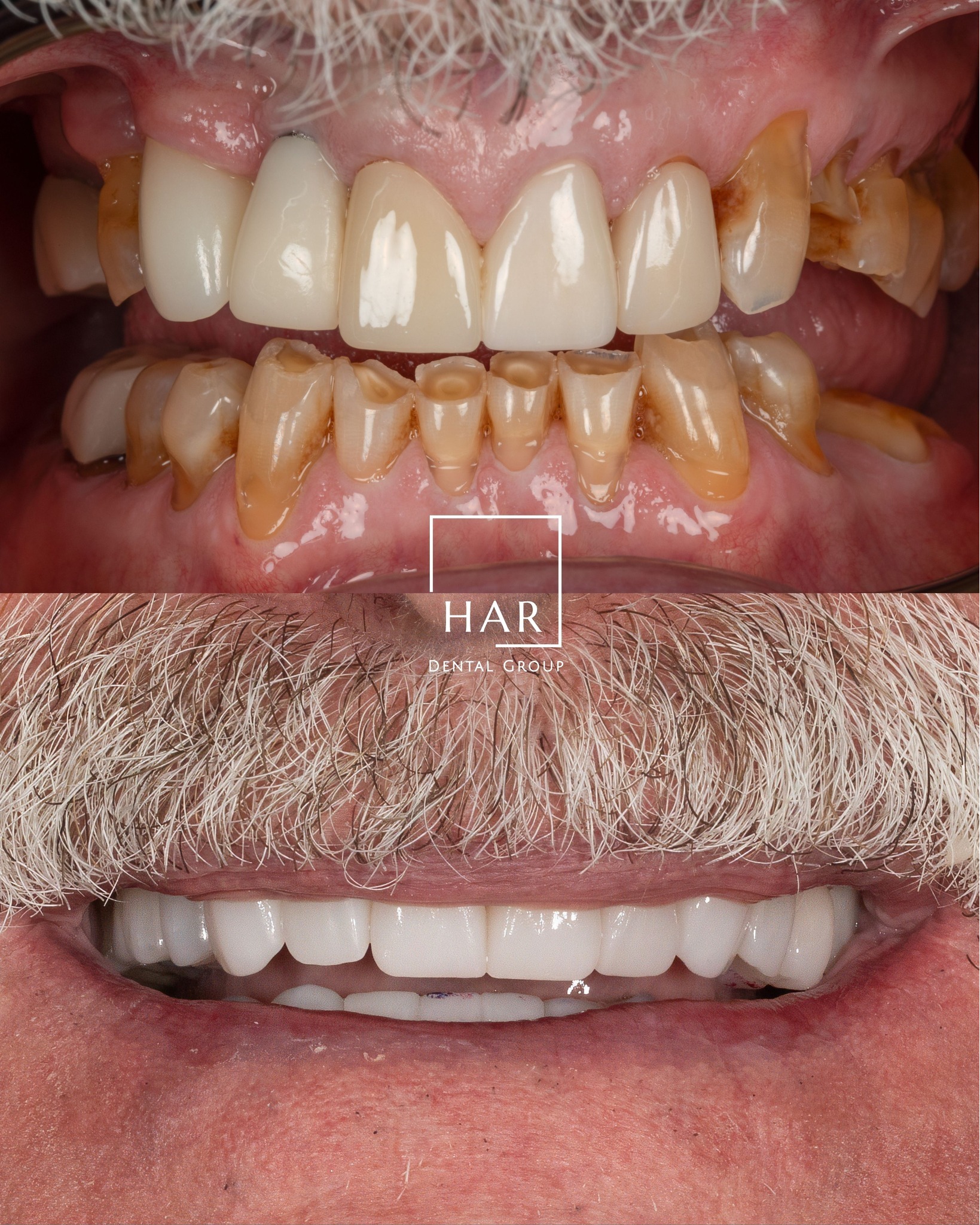 HAR Dental Facebook ad