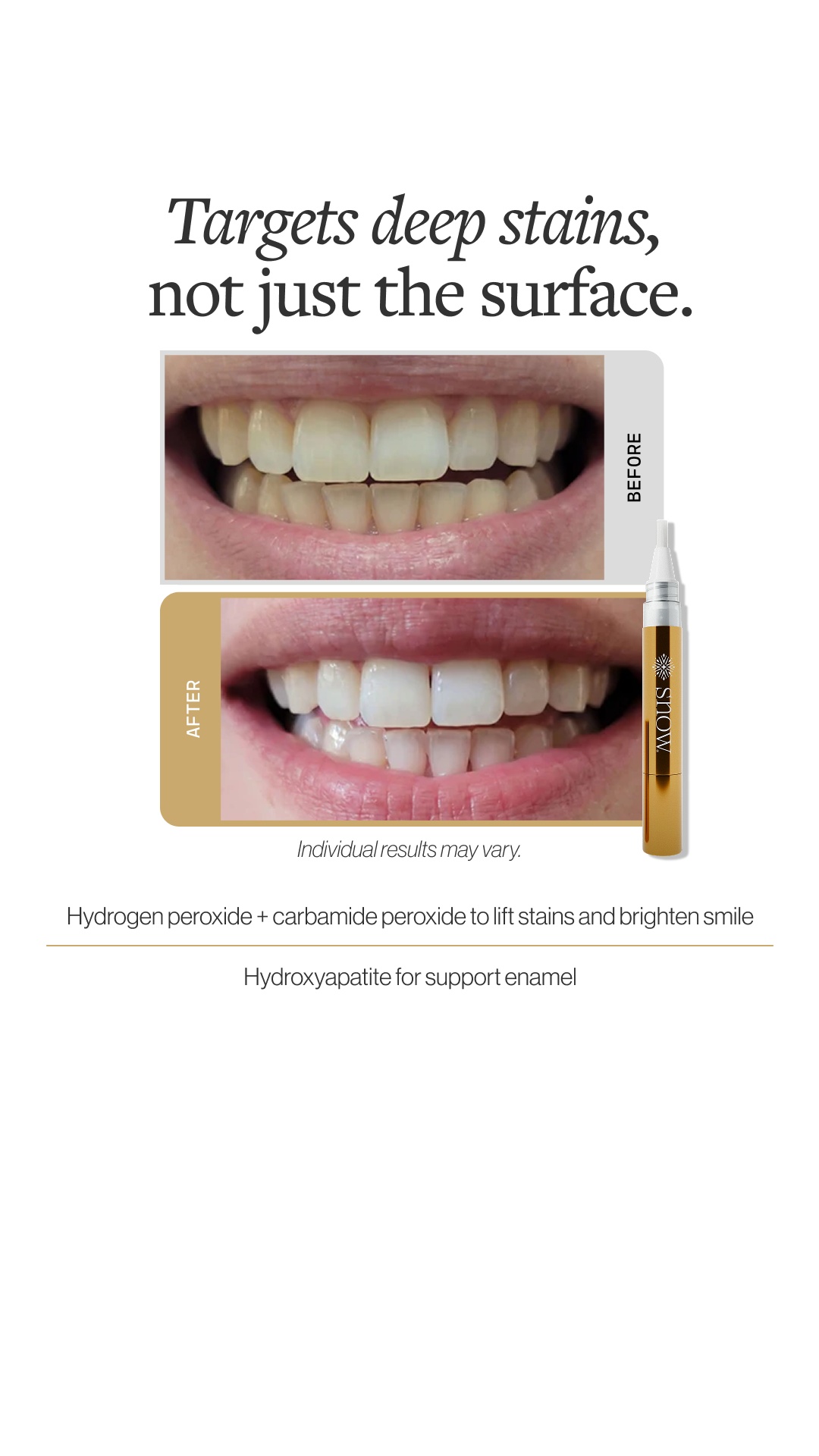 SNOW Teeth Whitening Facebook ad