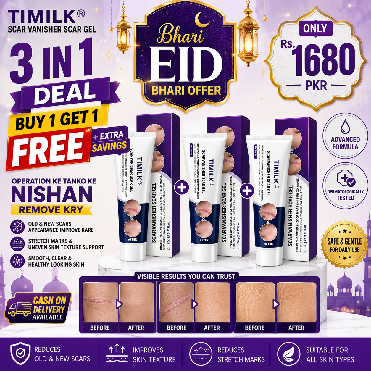 CosmoCare Facebook ad: TIMILK Scar Vanisher Gel | Buy 1 Get 1 Free