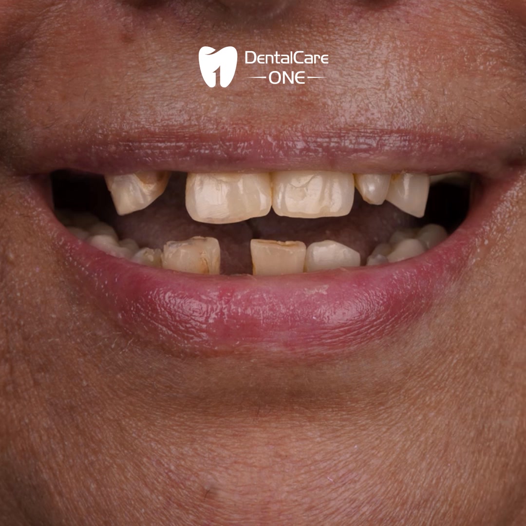 DentalCare One Albania Facebook ad: Kliko për detaje dhe çmim!