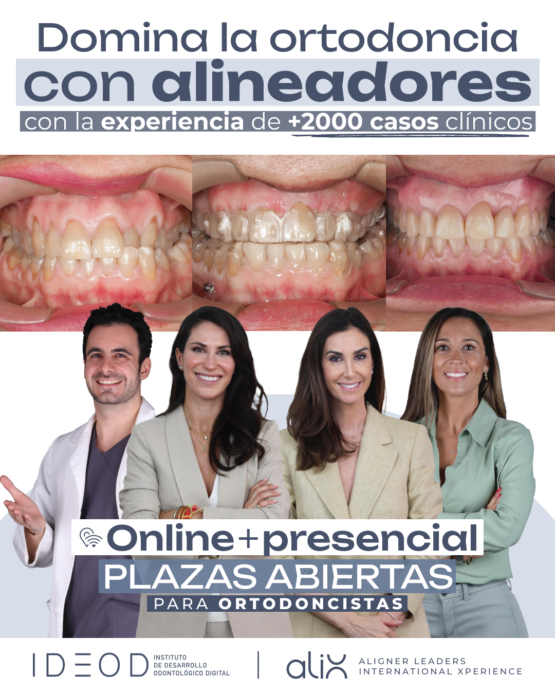 Instituto IDEOD Facebook ad: Domina los alineadores con +2.000 casos de experiencia