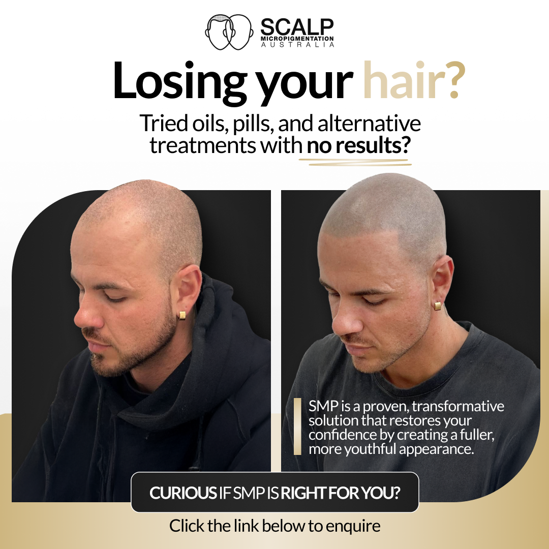 Scalp MicroPigmentation Australia Facebook ad