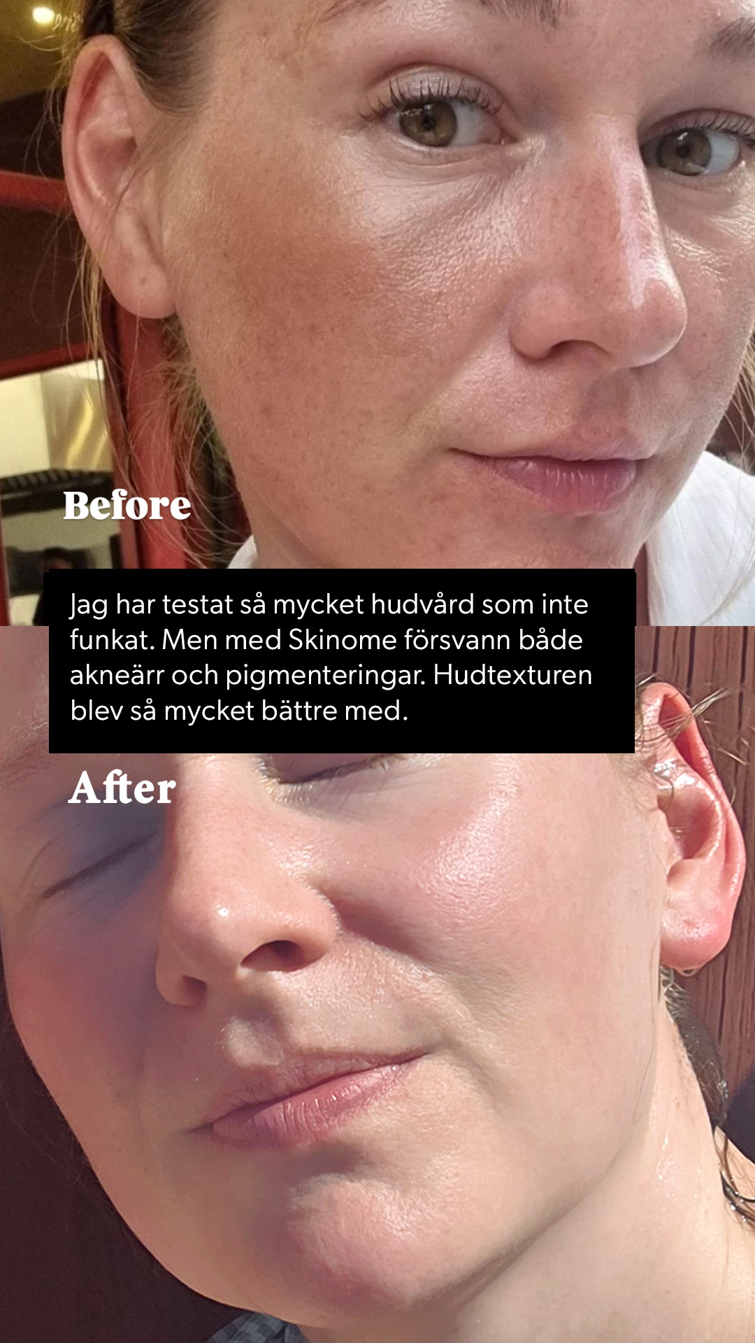 Skinome Facebook ad: Testat allt? Upptäck Skinome Azeretinal