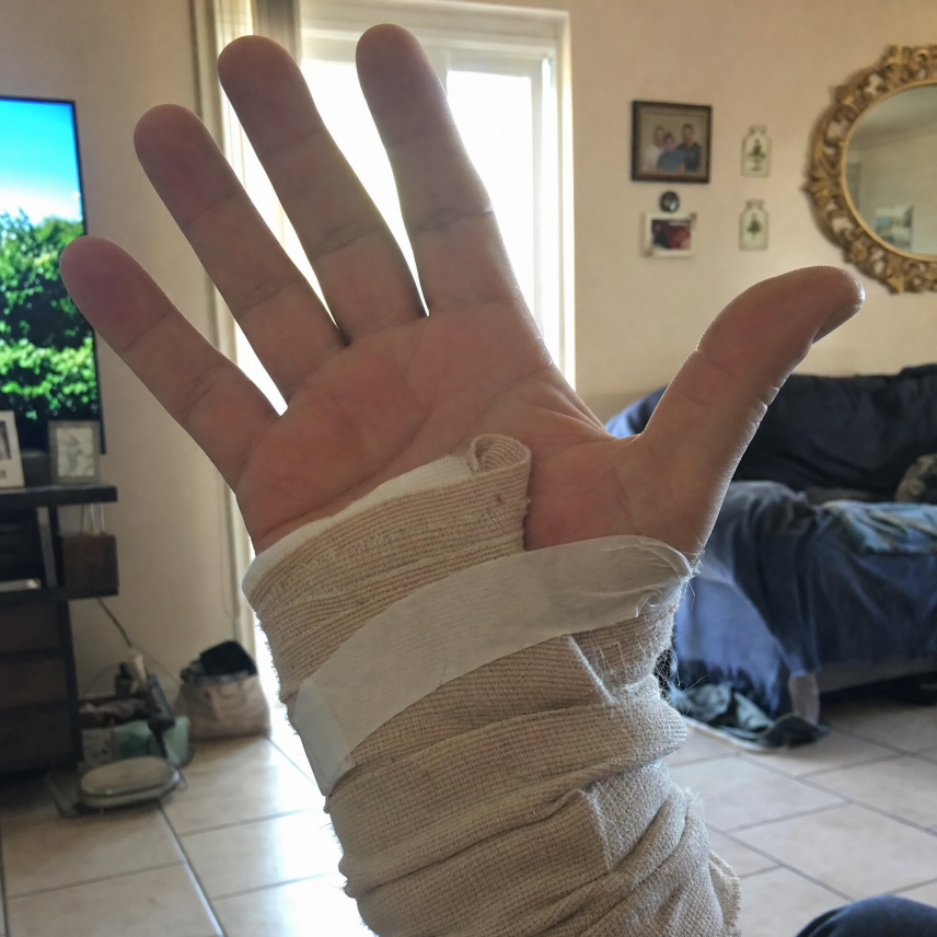 Carpal Tunnel Help Community Facebook ad: Anyone with carpal tunnel needs to see this