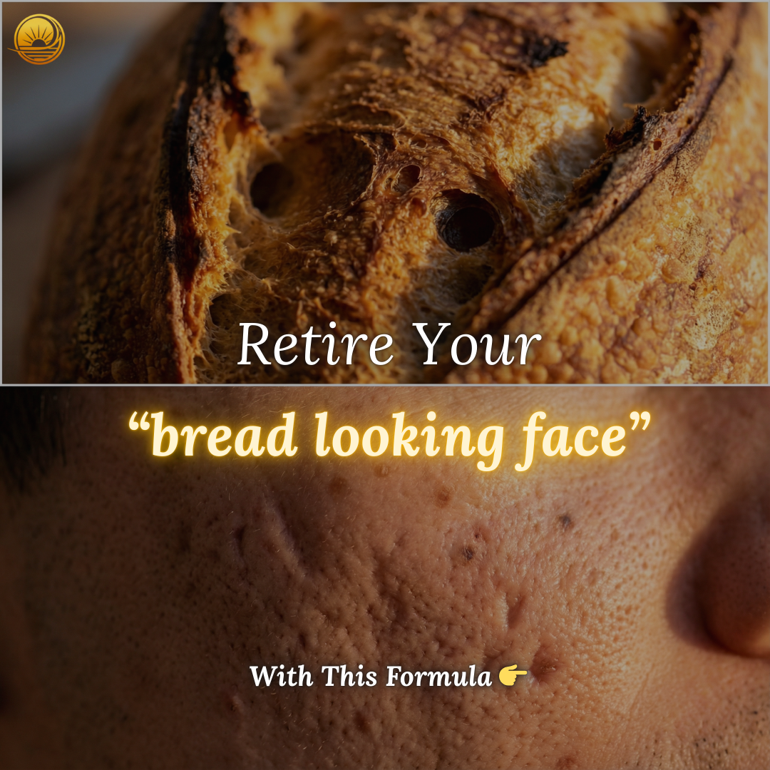 Terraura Facebook ad: Finally, a Serum That Finishes the Job
