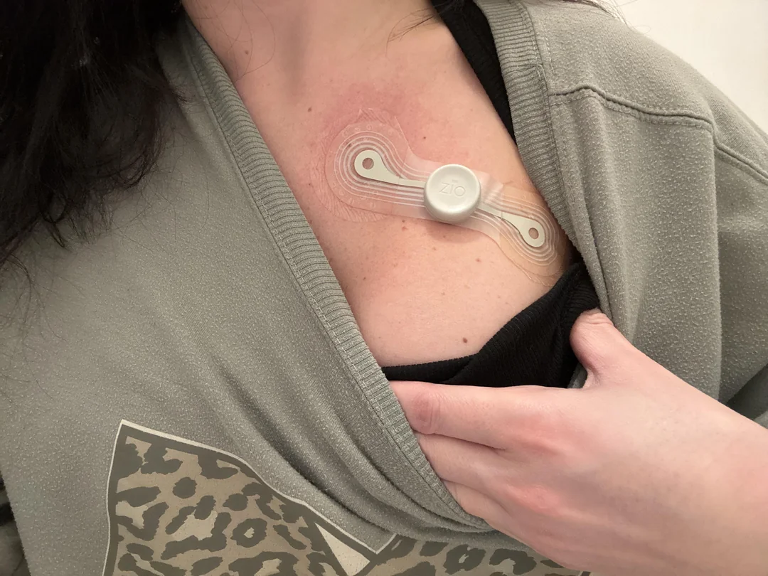 Barbara Turner Facebook ad: Nurse Refuses Her Own Statin