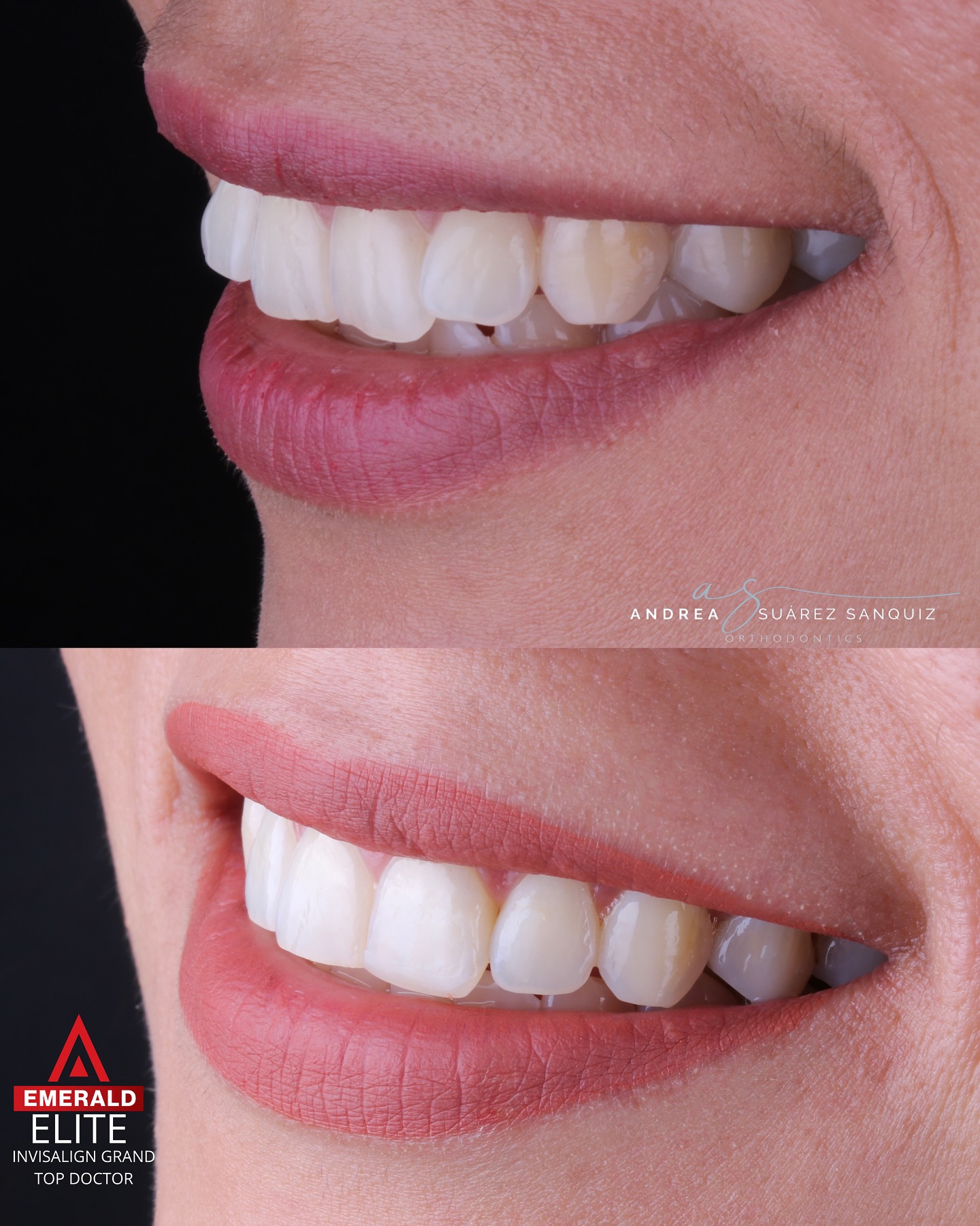 Dra. Andrea Suarez Orthodontics Facebook ad: A veces lo más simple siempre será lo…